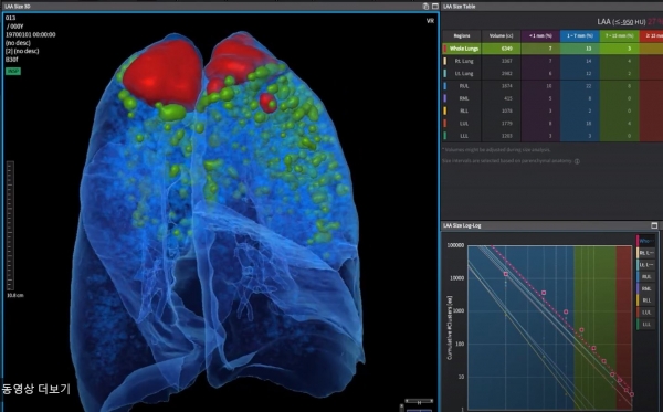 코어라인소프트의 3D 의료영상 솔루션. 사진=회사측 회사 동영상 캡쳐